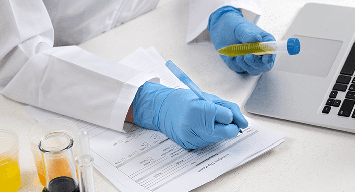 Nên sử dụng găng tay Nitrile khi làm việc trong môi trường tiếp xúc nhiều với virus, vi sinh vật (Nguồn ảnh: Sưu tầm)