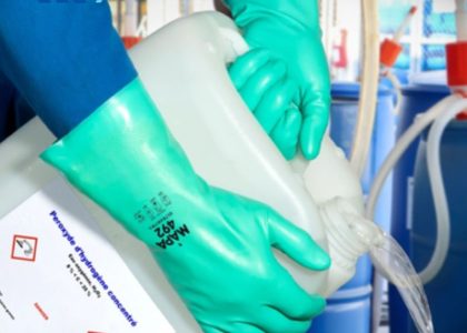 Tác hại khi không sử dụng găng tay bảo hộ chống hóa chất